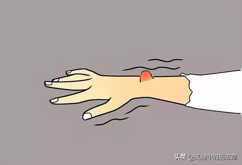 脂肪瘤一定要开刀吗？送你三味中药，一路攻、一路守、一路泻